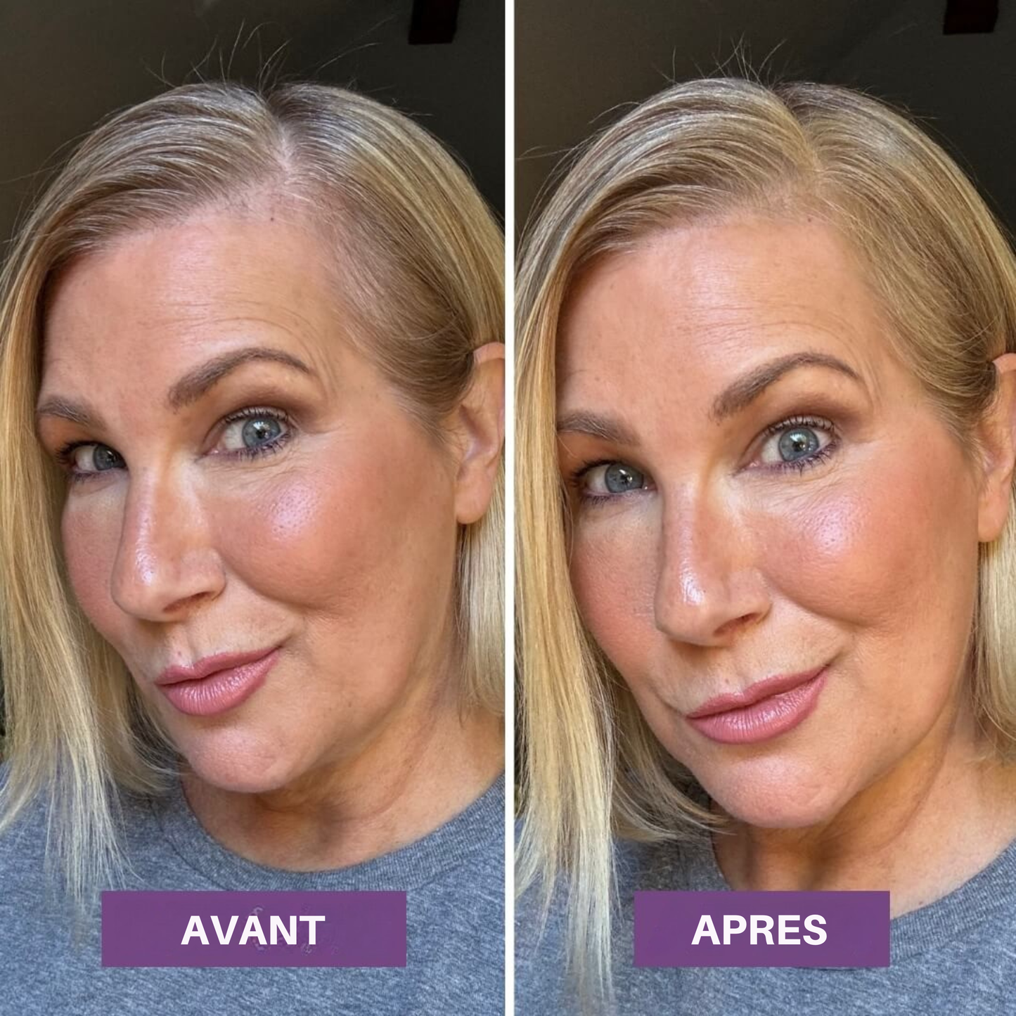 Veloria Magic+ La poudre qui redonne vie à votre ligne de cheveux — en 2 minutes.