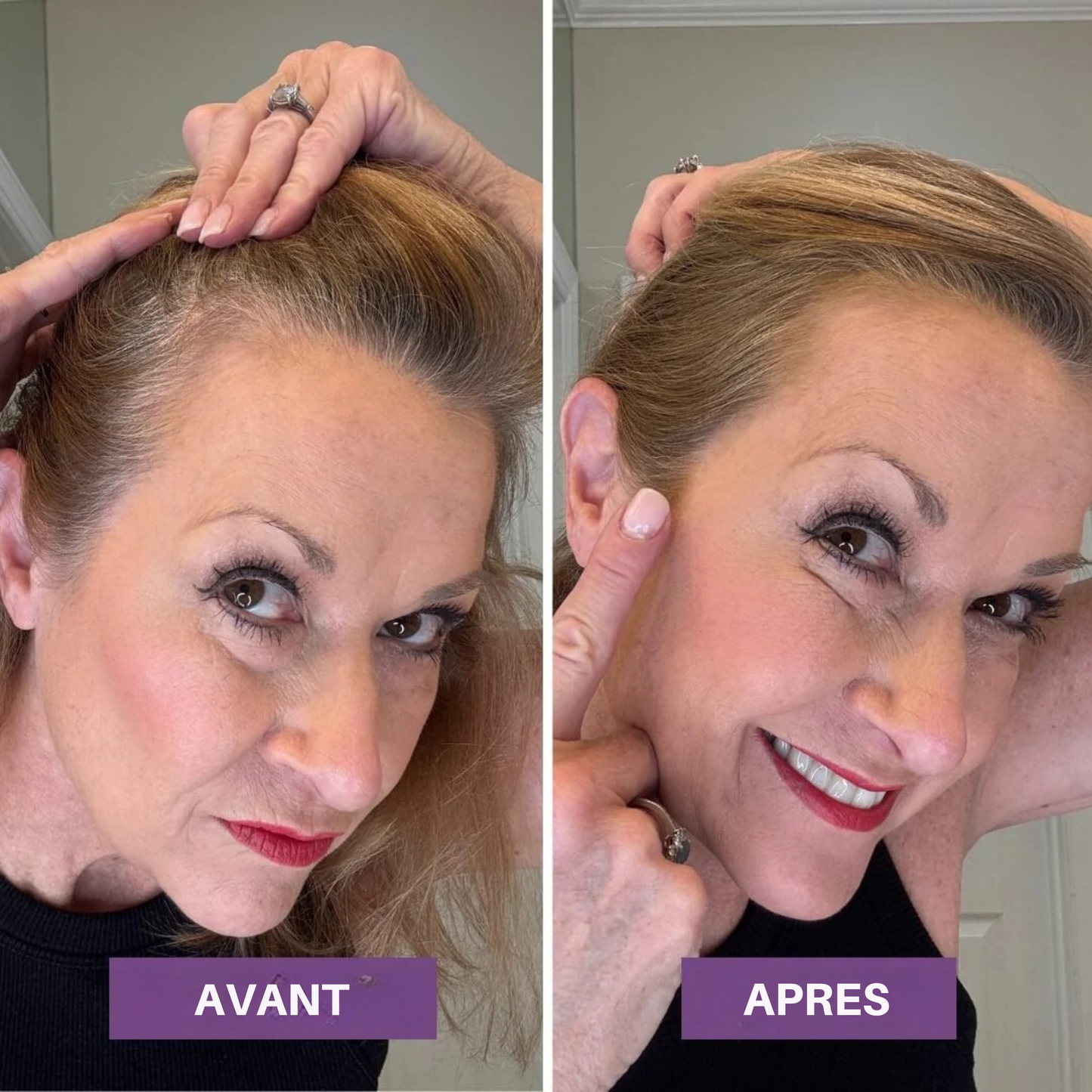 Veloria Magic+ La poudre qui redonne vie à votre ligne de cheveux — en 2 minutes.
