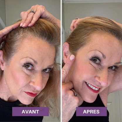 Veloria Magic+ La poudre qui redonne vie à votre ligne de cheveux — en 2 minutes.