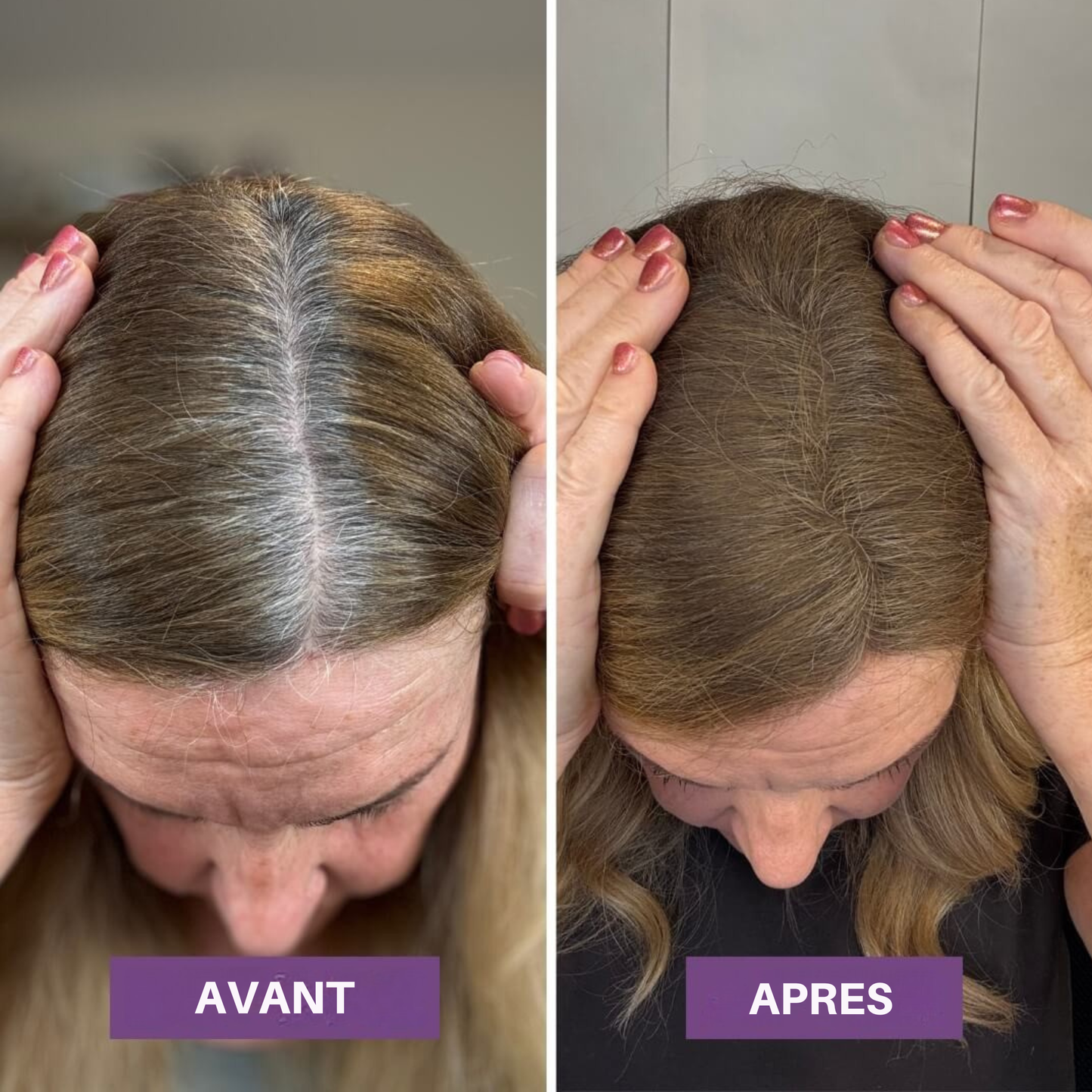 Veloria Magic+ La poudre qui redonne vie à votre ligne de cheveux — en 2 minutes.