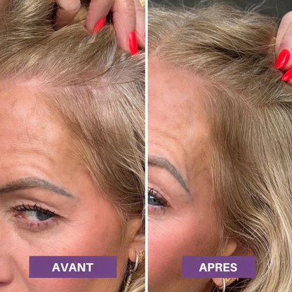 Veloria Magic+ La poudre qui redonne vie à votre ligne de cheveux — en 2 minutes.