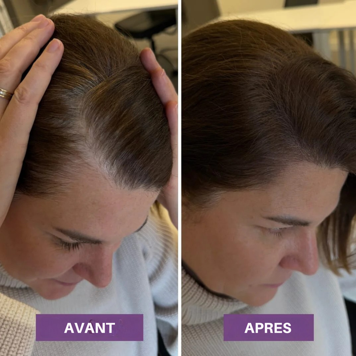 Veloria Magic+ La poudre qui redonne vie à votre ligne de cheveux — en 2 minutes.