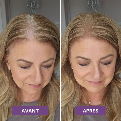 Veloria Magic+ La poudre qui redonne vie à votre ligne de cheveux — en 2 minutes.