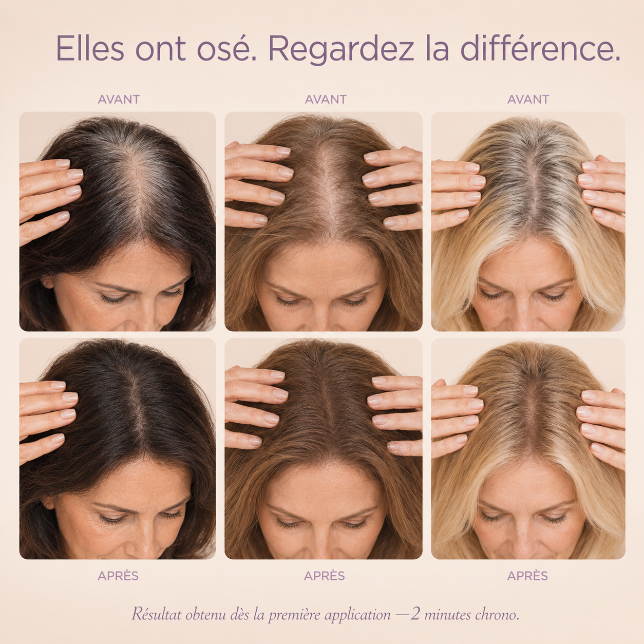 Veloria Magic+ La poudre qui redonne vie à votre ligne de cheveux — en 2 minutes.